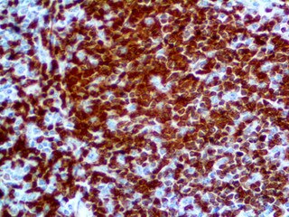 IHC of ZAP-70 on an FFPE Tonsil Tissue